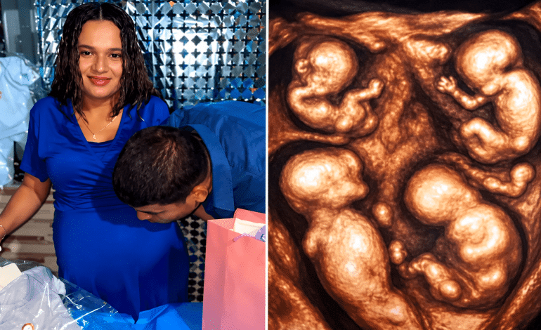 Cuatrillizos, una misma placenta: el extraordinario embarazo que lleva a una pareja de Caucasia a Medellín